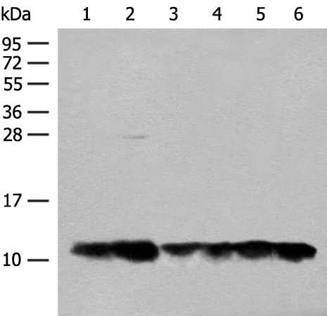 Western blot analysis of 293T cell Human fetal liver tissue lysates using ATP5L Polyclonal Antibody at dilution of 1:500