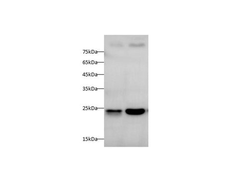Anti-Human/Mouse/Rat SOD2 Antibody - ABMIUM