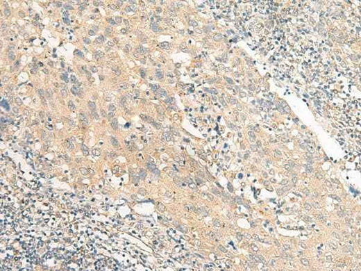 Anti-Human/Mouse/Rat CHP1 Antibody