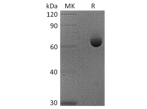 Recombinant Cynomolgus 5'-Nucleotidase/CD73/NT5E Protein (His Tag) - ABMIUM