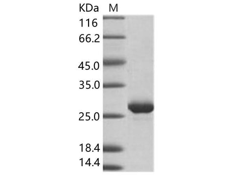 Recombinant EBOV (subtype Zaire, strain H.sapiens-wt/GIN/2014/Kissidougou-C15) VP24 Protein (His Tag) - ABMIUM