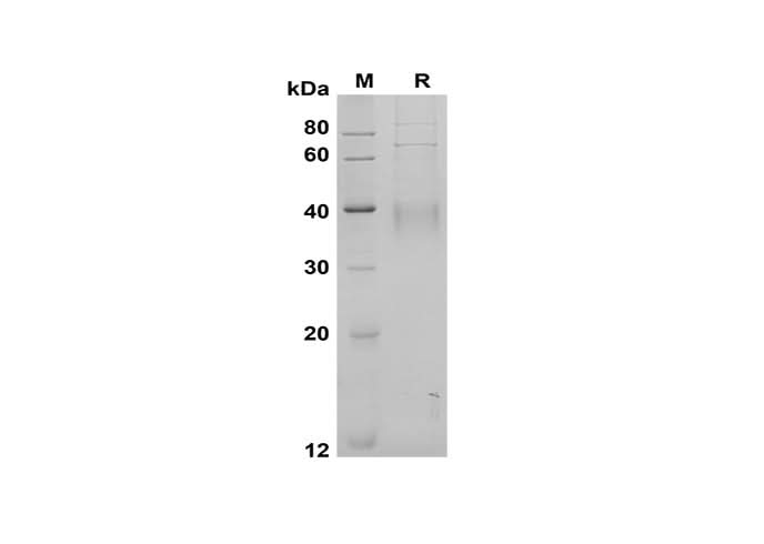 SDS-PAGE analysis of Human CD30 Ligand/TNFSF8 proteins, 2 μg/lane of Recombinant Human CD30 Ligand/TNFSF8 proteins was resolved with SDS-PAGE under reducing conditions, showing bands at 40 kDa.