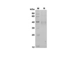 SDS-PAGE analysis of Human CD30 Ligand/TNFSF8 proteins, 2 μg/lane of Recombinant Human CD30 Ligand/TNFSF8 proteins was resolved with SDS-PAGE under reducing conditions, showing bands at 40 kDa.