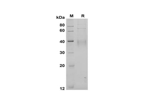 SDS-PAGE analysis of Human CD30 Ligand/TNFSF8 proteins, 2 μg/lane of Recombinant Human CD30 Ligand/TNFSF8 proteins was resolved with SDS-PAGE under reducing conditions, showing bands at 40 kDa.