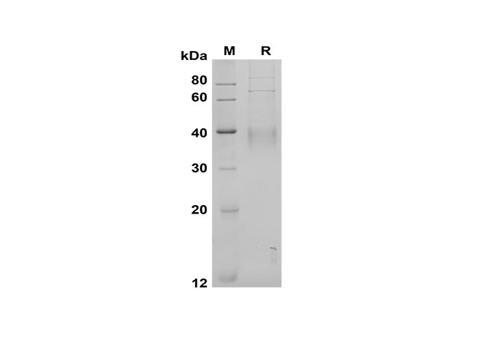 SDS-PAGE analysis of Human CD30 Ligand/TNFSF8 proteins, 2 μg/lane of Recombinant Human CD30 Ligand/TNFSF8 proteins was resolved with SDS-PAGE under reducing conditions, showing bands at 40 kDa.