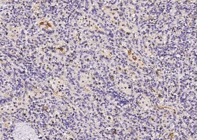 Anti-Human FOLR2 Antibody [B146] - ABMIUM