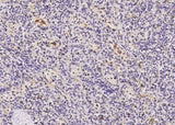 Anti-Human FOLR2 Antibody [B146]