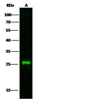 Anti-Human CST7 Antibody [A1019] - ABMIUM
