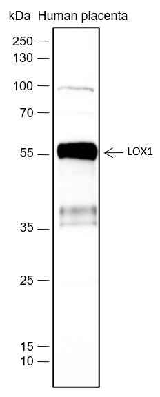 Anti-Human OLR1/LOX1 Antibody [A467] - ABMIUM