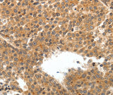 Anti-Human/Mouse TEK Antibody - ABMIUM