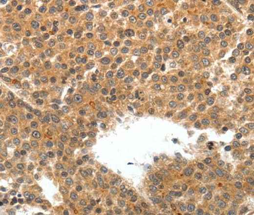 Anti-Human/Mouse TEK Antibody