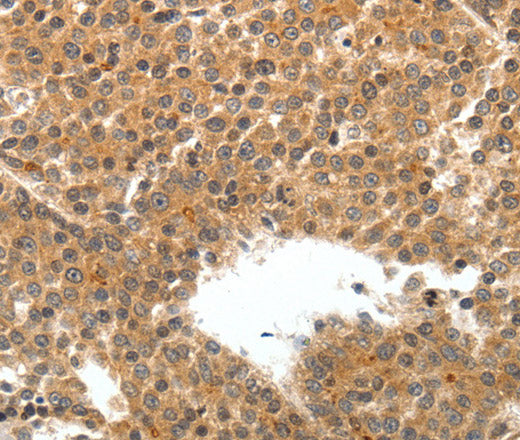 Anti-Human/Mouse TEK Antibody - ABMIUM
