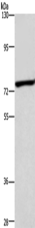Anti-Human/Mouse/Rat ABCB8 Antibody - ABMIUM