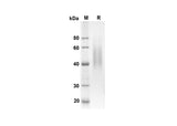 SDS-PAGE analysis of Rat CD86 proteins, 2 μg/lane of Recombinant Rat CD86 proteins was resolved with an SDS-PAGE under reducing conditions, showing bands at 24.3 kDa.