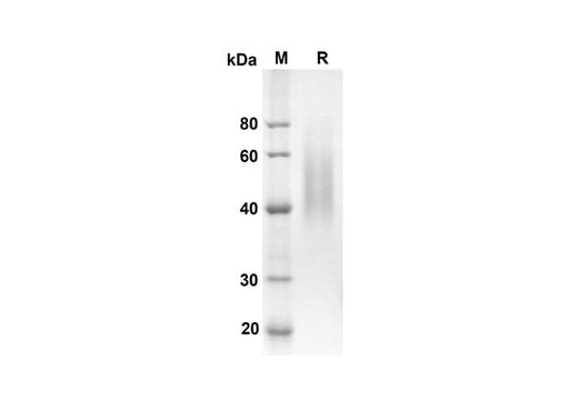 SDS-PAGE analysis of Rat CD86 proteins, 2 μg/lane of Recombinant Rat CD86 proteins was resolved with an SDS-PAGE under reducing conditions, showing bands at 24.3 kDa.