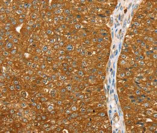 Anti-Human/Rat ABCC8 Antibody