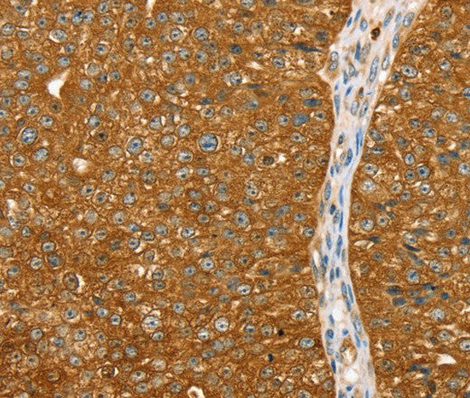 Anti-Human/Rat ABCC8 Antibody - ABMIUM