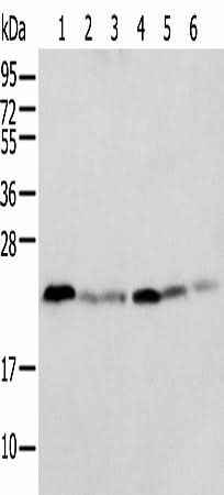 Anti-Human/Mouse/Rat SPCS2 Antibody