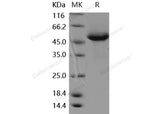 Recombinant Human RAB27B Protein (Fc Tag) - ABMIUM