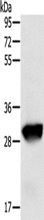 Anti-Human GSTO1 Antibody - ABMIUM