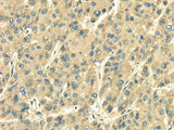 Anti-Human/Mouse/Rat SDF4 Antibody - ABMIUM