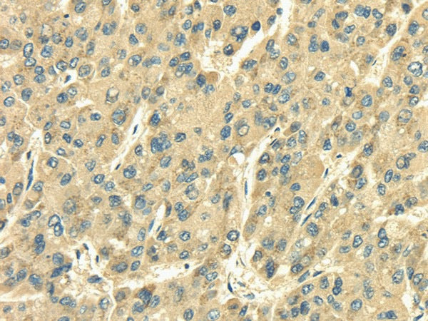 Anti-Human/Mouse/Rat SDF4 Antibody - ABMIUM