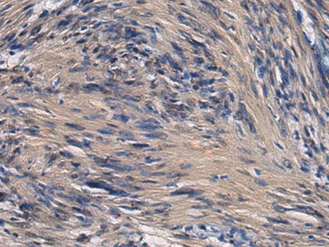 Immunohistochemistry of paraffin-embedded Human brain tissue using ICA1 Polyclonal Antibody at dilution of 1:70(×200)