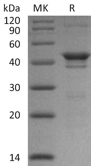 Recombinant Human NAD Kinase/NADK Protein (His Tag) - ABMIUM