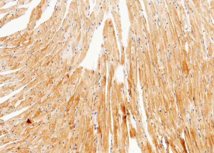 Anti-Mouse UCHL3 Antibody [B476] - ABMIUM