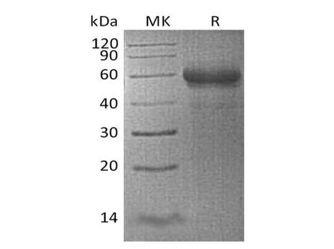 Recombinant Human TNFSF4/OX40L Protein (mFc Tag) - ABMIUM