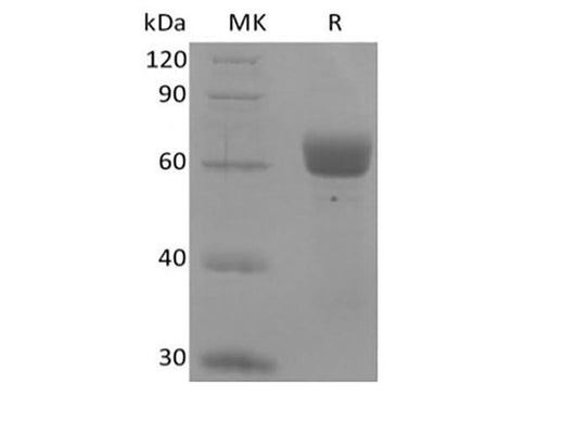 Recombinant Human Butyrophilin-like Protein 9/BTNL9 (C-Fc) - ABMIUM