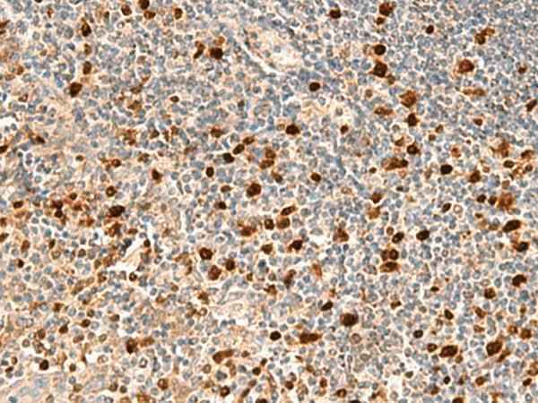 Anti-Human/Rat DUT Antibody
