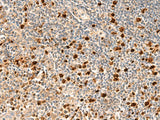 Immunohistochemistry of paraffin-embedded Human tonsil tissue using DUT Polyclonal Antibody at dilution of 1:70(×200)