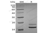 Recombinant Human ERMAP Protein (His Tag) - ABMIUM