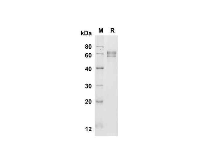 SDS-PAGE analysis of Mouse Fetuin B proteins , 2 μg/lane of Recombinant Mouse Fetuin B proteins was resolved with SDS-PAGE under reducing conditions , showing bands at 60 kDa.