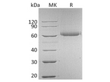 Recombinant Human FGFR5/FGFRL1 Protein (His Tag) - ABMIUM