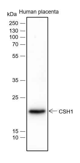 Anti-Human Placental Lactogen Antibody [A259] - ABMIUM