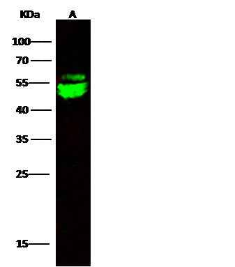 Anti-Mouse CNDP2 Antibody [B426]