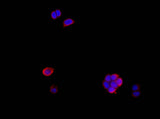 Anti-Human Amphiregulin Antibody - ABMIUM