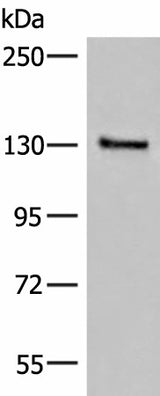 Western blot analysis of Human urinary bladder tissue lysate using SASH1 Polyclonal Antibody at dilution of 1:300