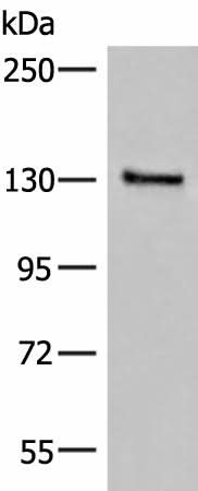 Western blot analysis of Human urinary bladder tissue lysate using SASH1 Polyclonal Antibody at dilution of 1:300