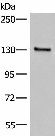 Western blot analysis of Human urinary bladder tissue lysate using SASH1 Polyclonal Antibody at dilution of 1:300