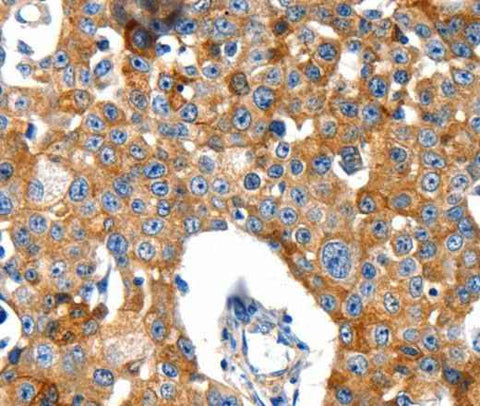 Anti-Human/Mouse/Rat GluR2 Antibody