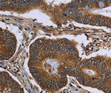 Anti-Human/Mouse/Rat FHIT Antibody - ABMIUM