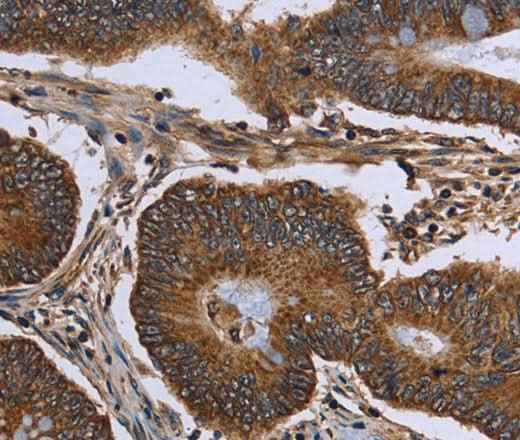 Anti-Human/Mouse/Rat FHIT Antibody