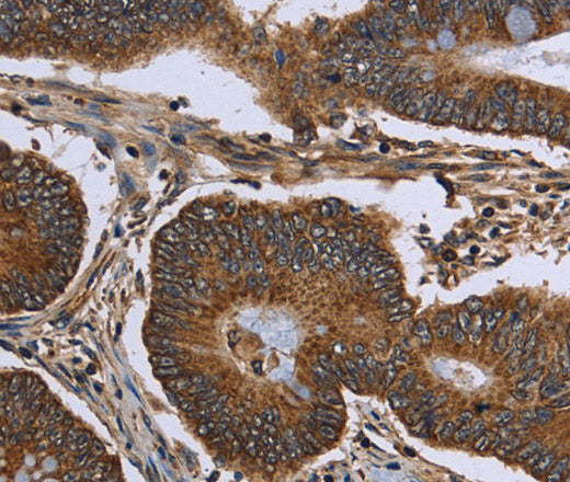 Anti-Human/Mouse/Rat FHIT Antibody - ABMIUM