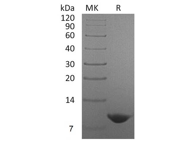 Recombinant Human Nucleobindin-2/NUCB2 Protein - ABMIUM