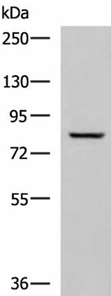 Western blot analysis of Human tongue tissue lysate using TGM3 Polyclonal Antibody at dilution of 1:800