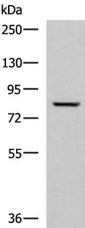 Western blot analysis of Human tongue tissue lysate using TGM3 Polyclonal Antibody at dilution of 1:800