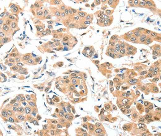 Anti-Human/Mouse ADCK1 Antibody